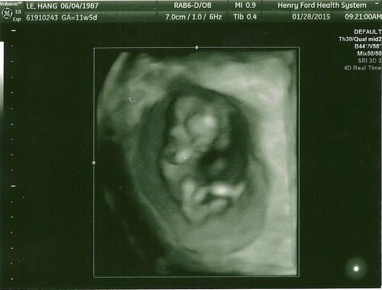 Pryor-Baby-Image-3D